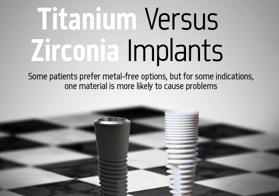 Titanium Dental Implants