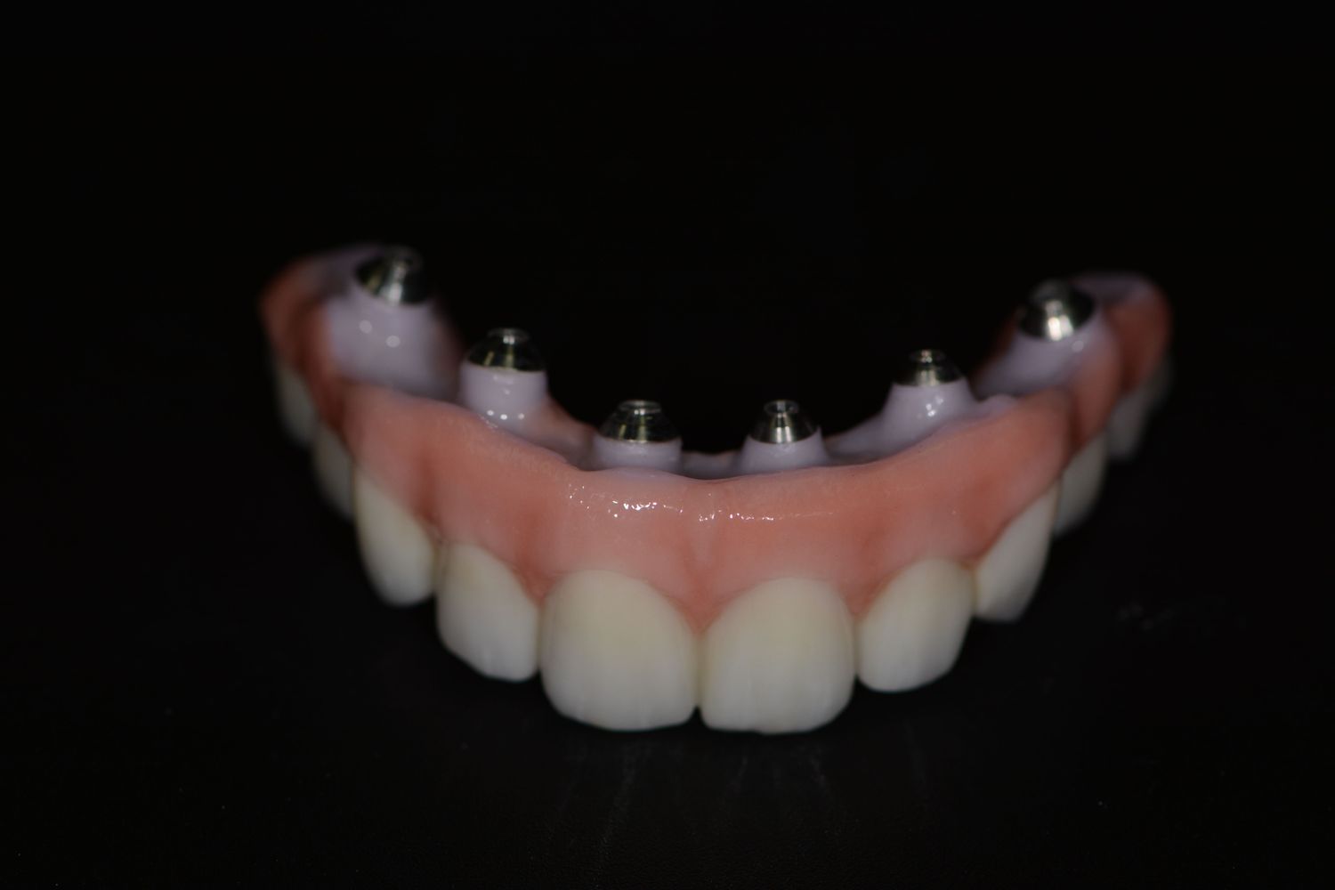 Beyond Dentures