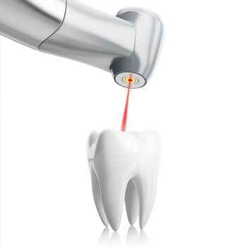 laser on tooth